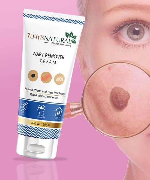 Wart Removal Cream