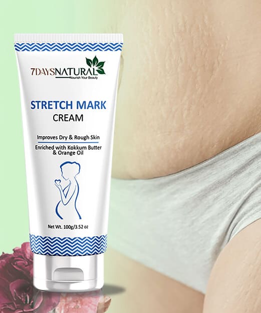 Stretch Marks Removal Cream
